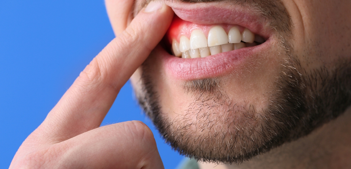 Why Oral Hygiene Is Key to Gum Disease Prevention