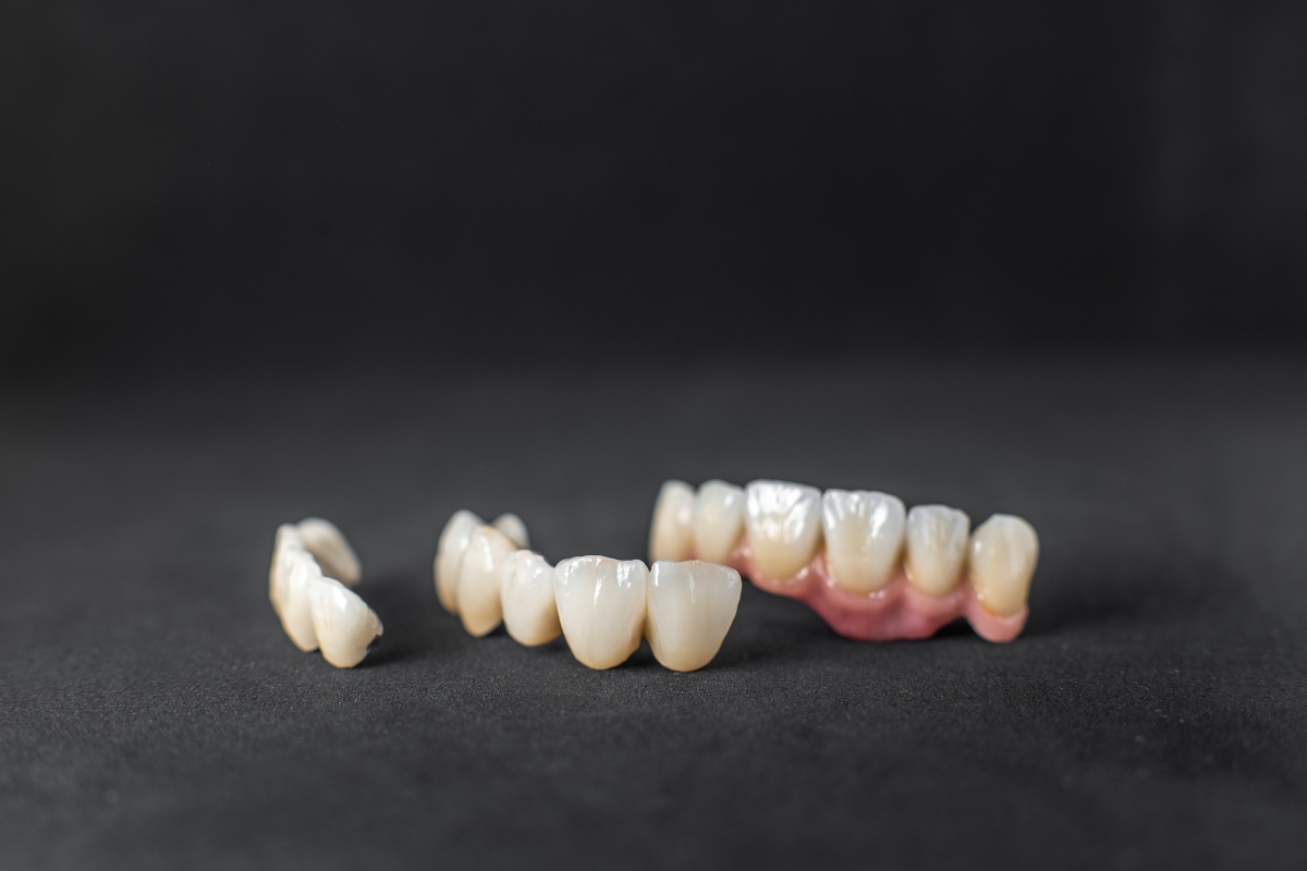 Dental crowns for teeth