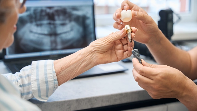 Dental Implants
